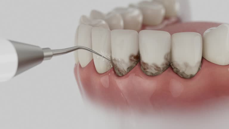 Trusted Invisalign Clear Aligners service in Camarillo, CA - Dentist Open Now